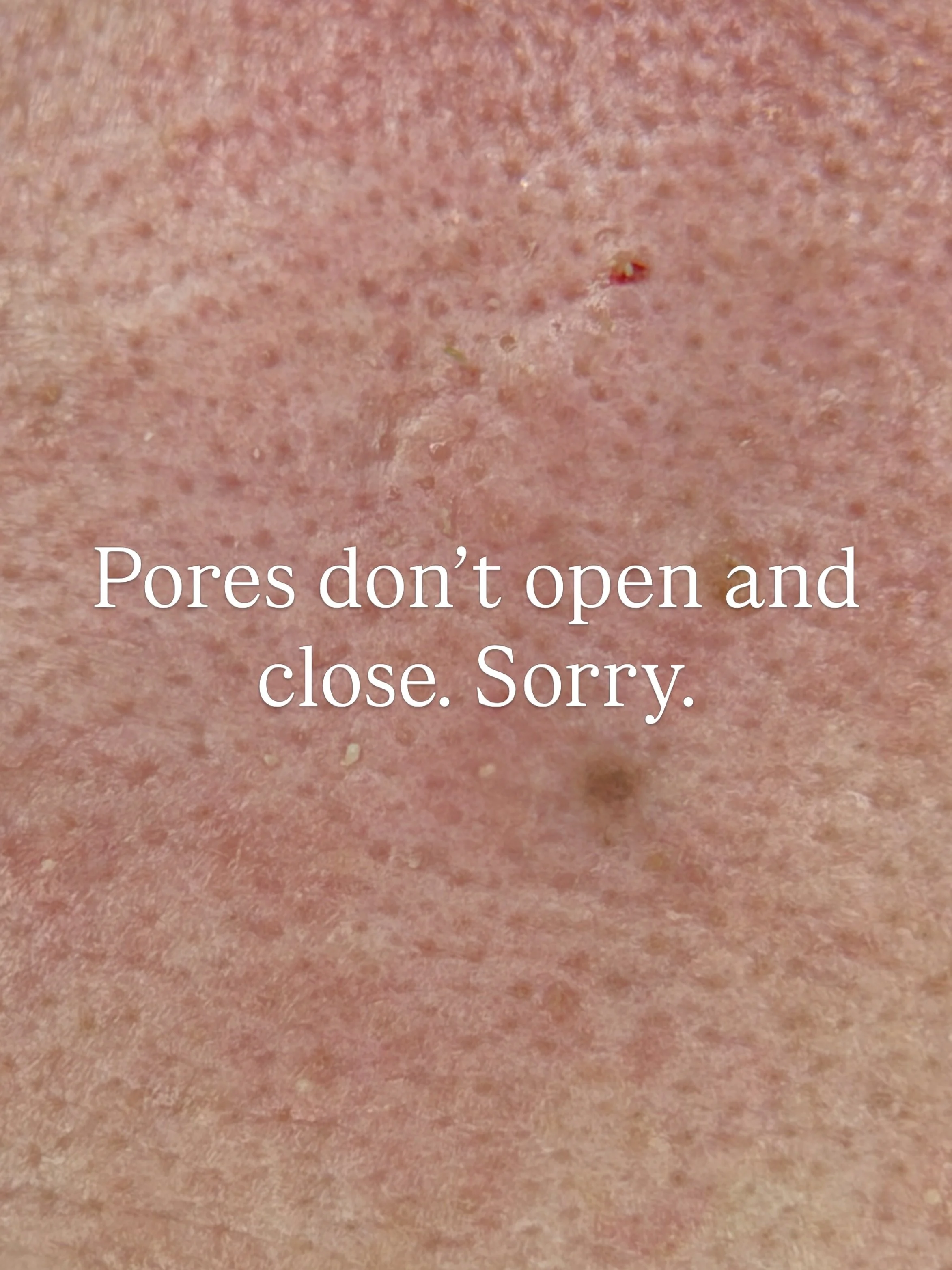 Let&rsquo;s talk about those little dots that everyone wants gone (spoiler: they&rsquo;re not always what you think haha). Here&rsquo;s a close up under the magnifier&hellip;👀

There are two things people often confuse:

⚫ Blackheads. These are bloc
