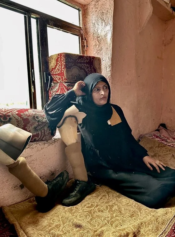 Dalila Abdo Ahmed sits beside her prosthetic limbs inside her room in Taiz. Five other people were killed or injured by the same minefield that wounded her near the family’s former home outside the city.