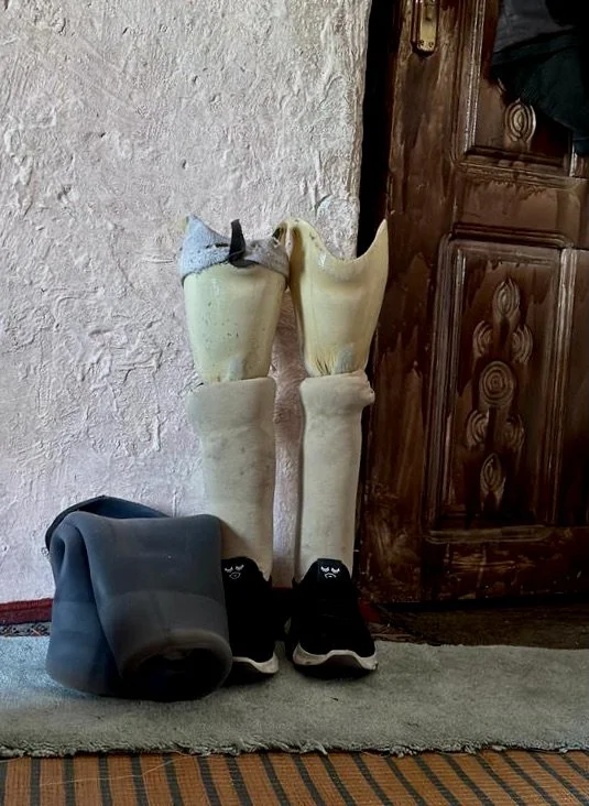 The prosthetic limbs of Dalila Abdo Ahmed stand inside her apartment in Taiz, Yemen. Despite trauma, displacement and the stigma attached to women disabled by war injuries, Dalila continues to rebuild her life with determination and independence.