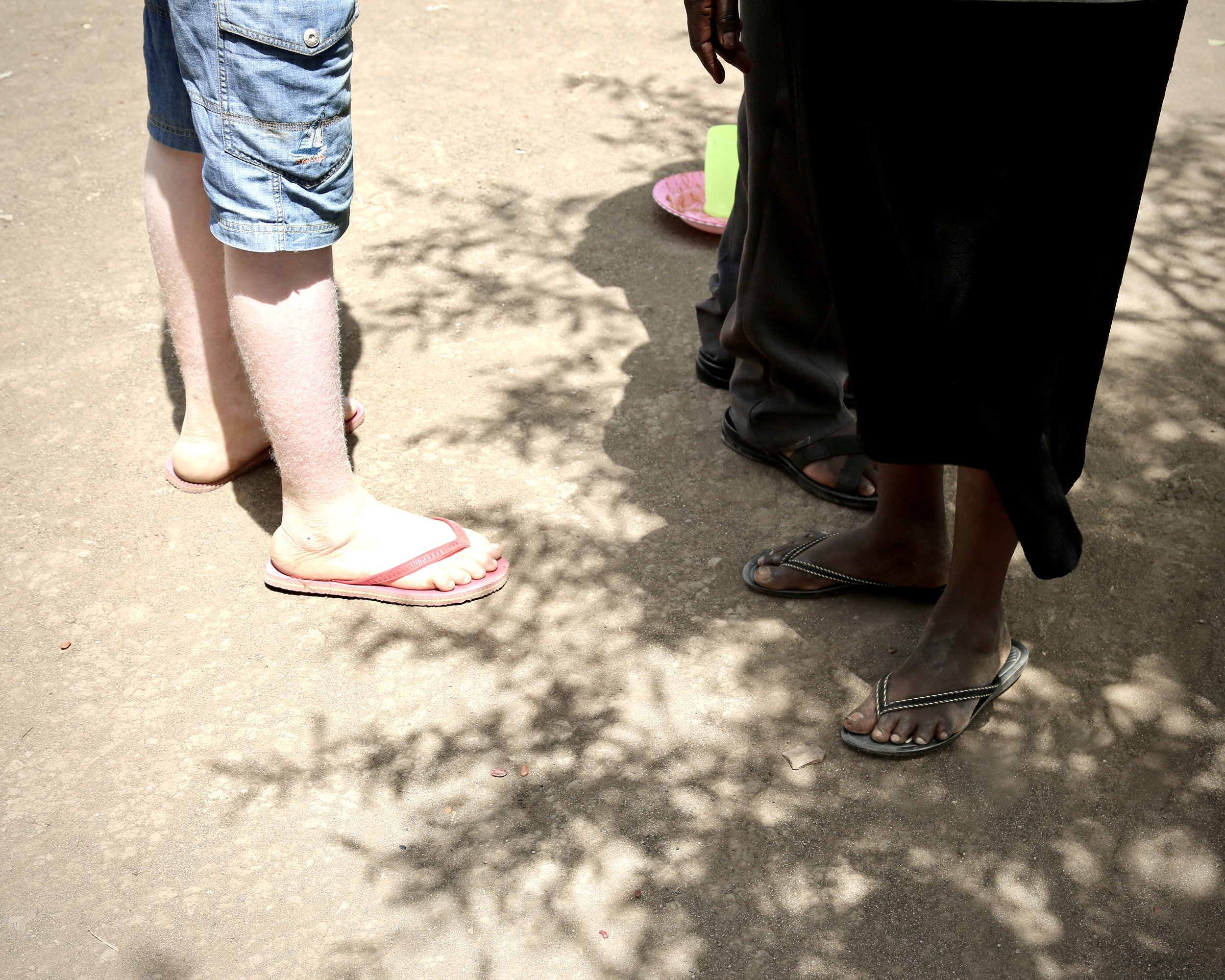 Evariste stands beside another resident inside the compound. His albinism made him highly visible in a region where people with the condition are often targeted by violent superstition.