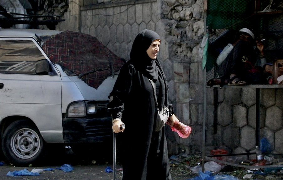 Dalila Abdo Ahmed walks through a street in Taiz city using a cane. After surviving the blast, Dalila struggled to find prosthetic limbs that allowed her to move comfortably in a country where much of the healthcare system has been damaged by years o
