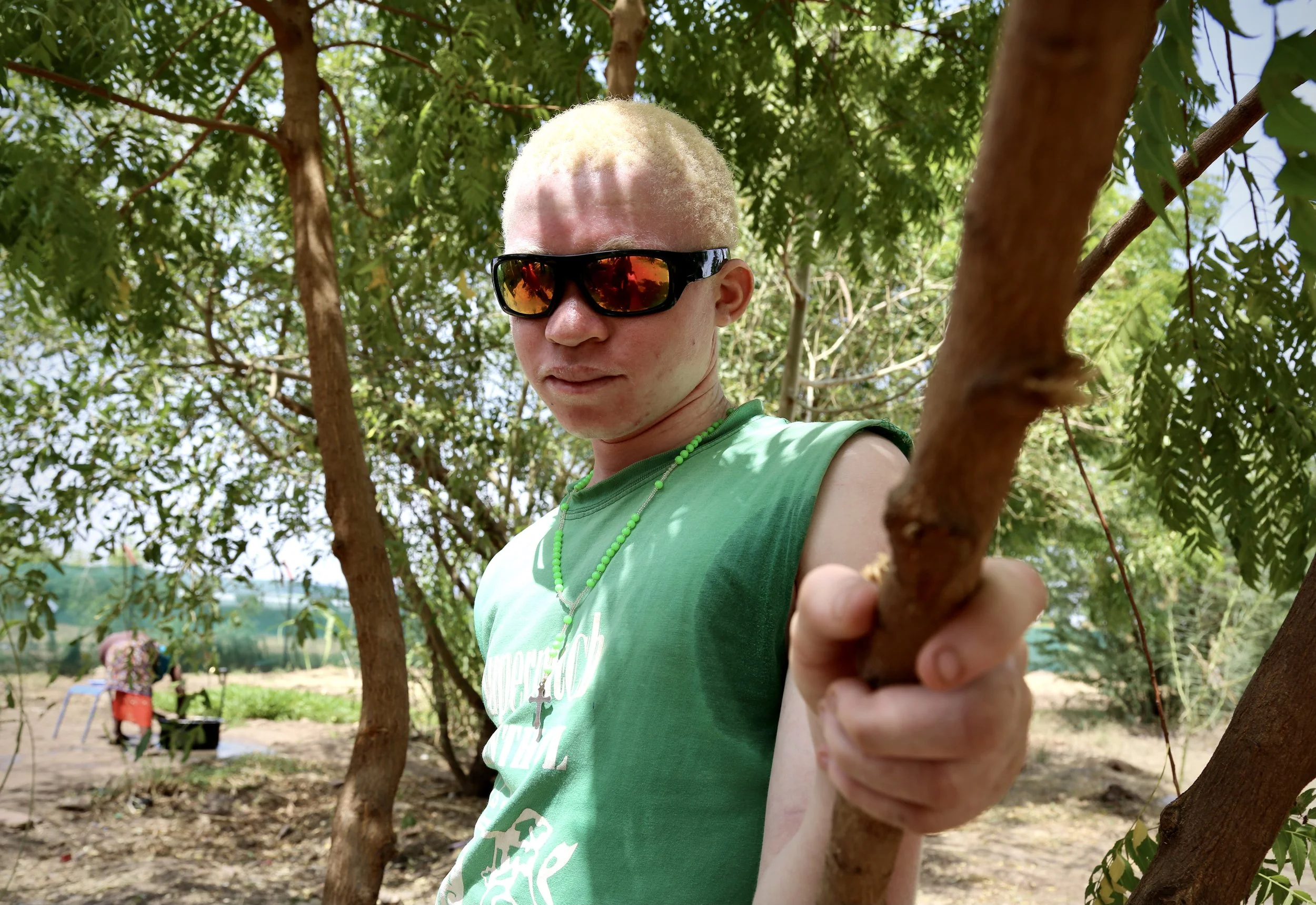 Evariste poses beneath trees in Kakuma refugee camp. He hoped one day to become an advocate for people living with albinism.