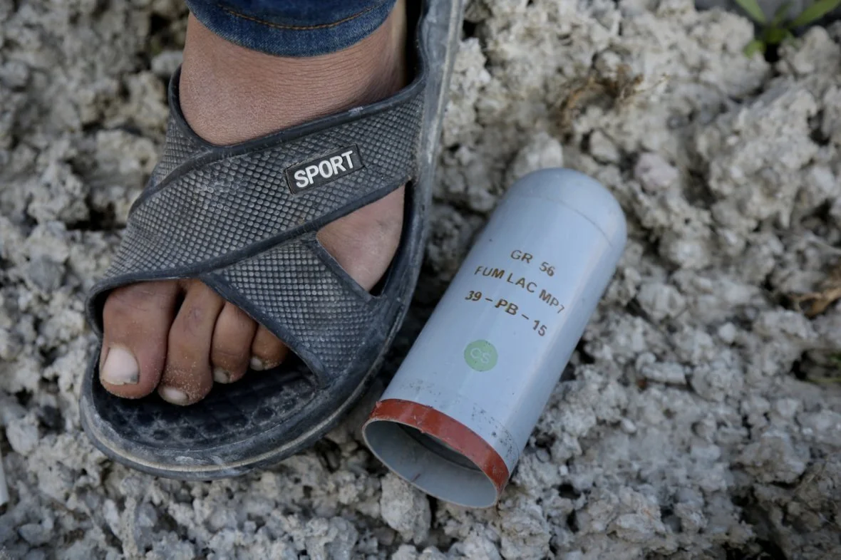 A tear gas canister lies beside the foot of Qaid, a young refugee from Afghanistan in the Calais “Jungle” camp in northern France. Children in the camp alleged French police regularly used tear gas during clashes near roads, fences, and lorry routes 