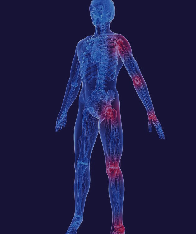 arthritis.jpg