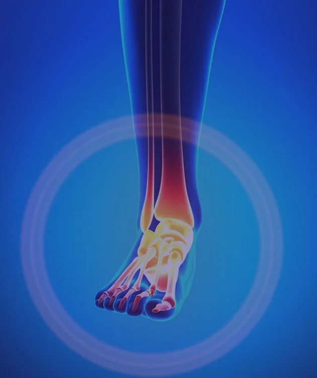 foot dysfunction.jpg
