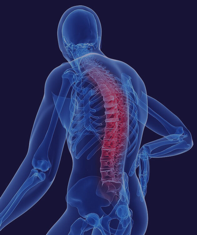 Functional Scoliosis.jpg