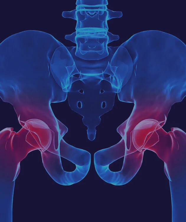 hip pain.jpg