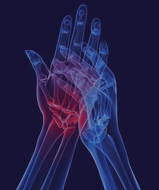 Nerve irritation.jpg