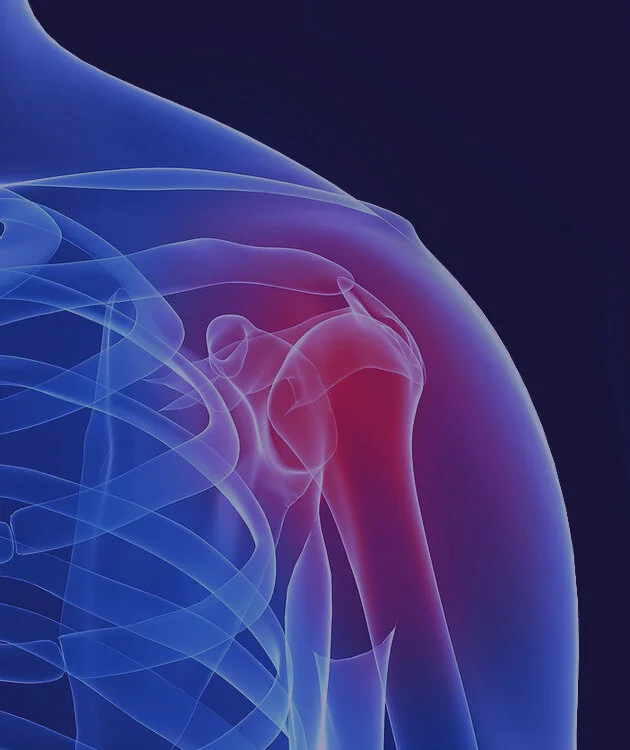 shoulder pain.jpg