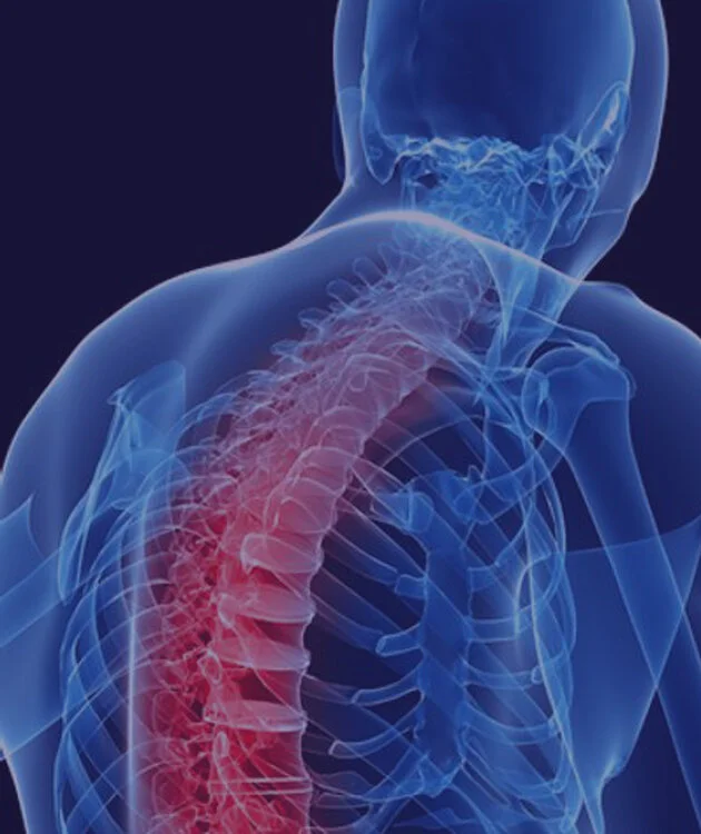 upper back pain.jpg