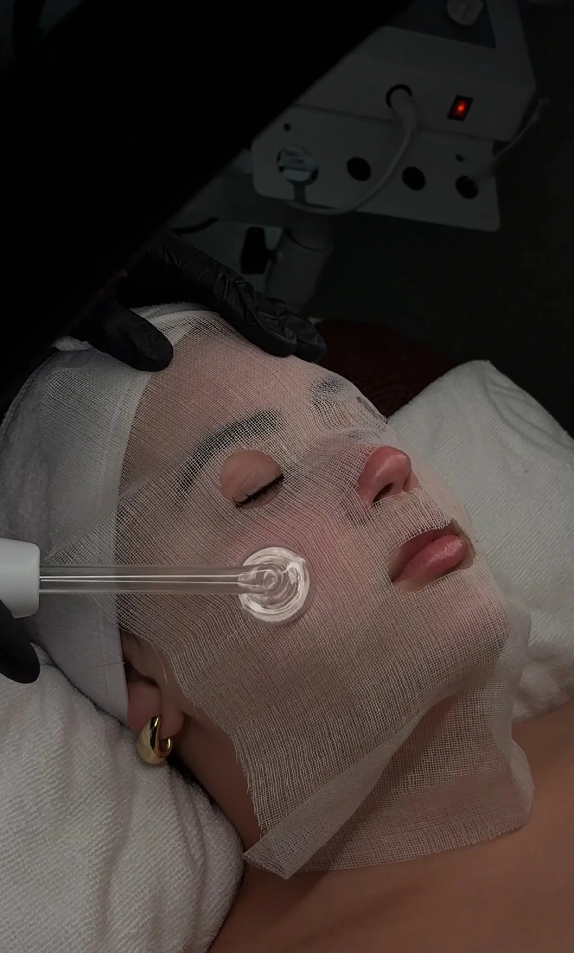 Acne Clarifying Protocol | $99.99 | The Acne Clarifying protocol targets breakouts at the source using a cocktail of acne treatments designed for your acne type and concerns.
