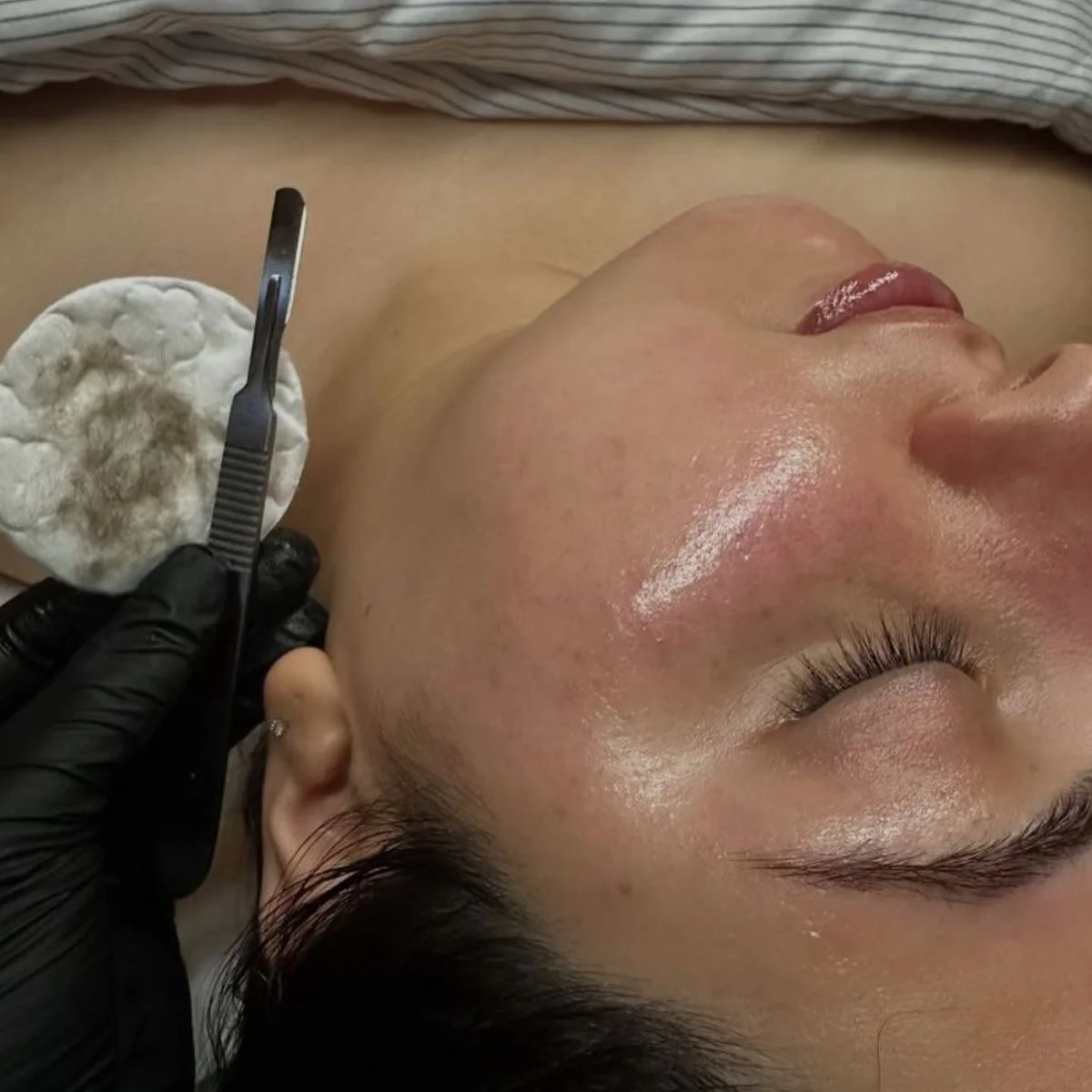 Dermaplane Treatment | $69.99 | An exfoliating treatment that removes dead skin cells and fine vellus hair, revealing a smoother, brighter complexion with enhanced product absorption.
