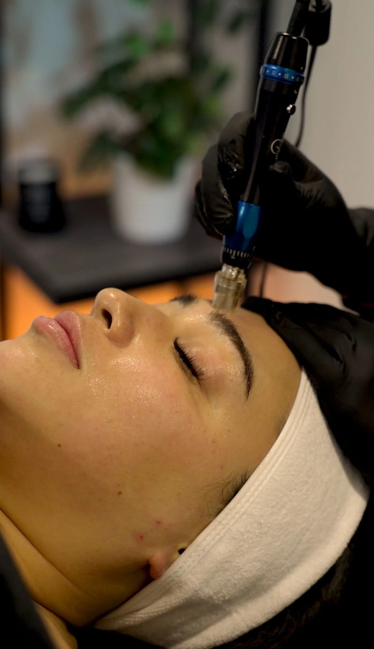 Pro Microneedling Treatment | $149.99 | Microneedling done with salmon DNA stimulates collagen production. This procedure is especially effective for treating acne scars, fine lines, enlarged pores, dullness, and skin elasticity.
