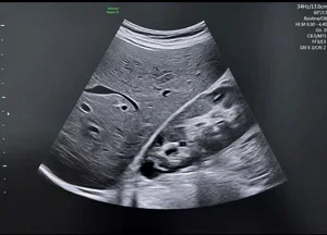 liver+kidney.webp