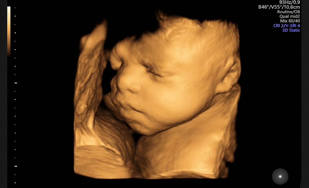 28 - 32 weeks