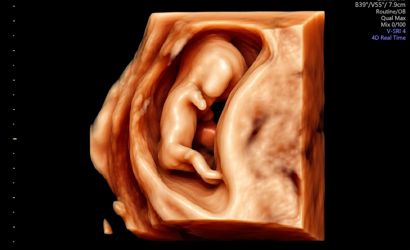 E4C220C9-E280-440C-BB2C-123F8316F6C8.PNG