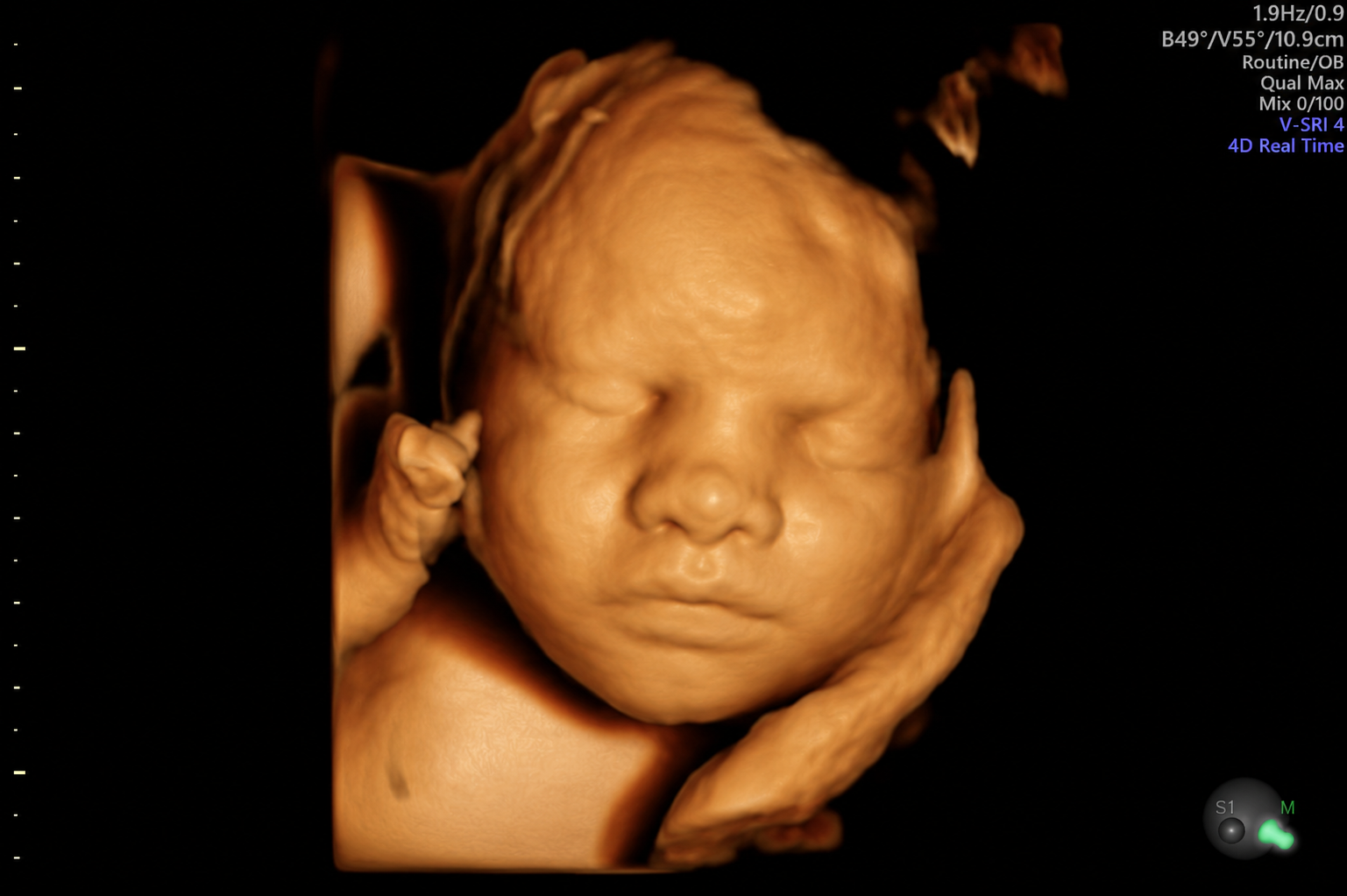 7901D26D-8CA4-41A9-A765-472A38A0781D.PNG