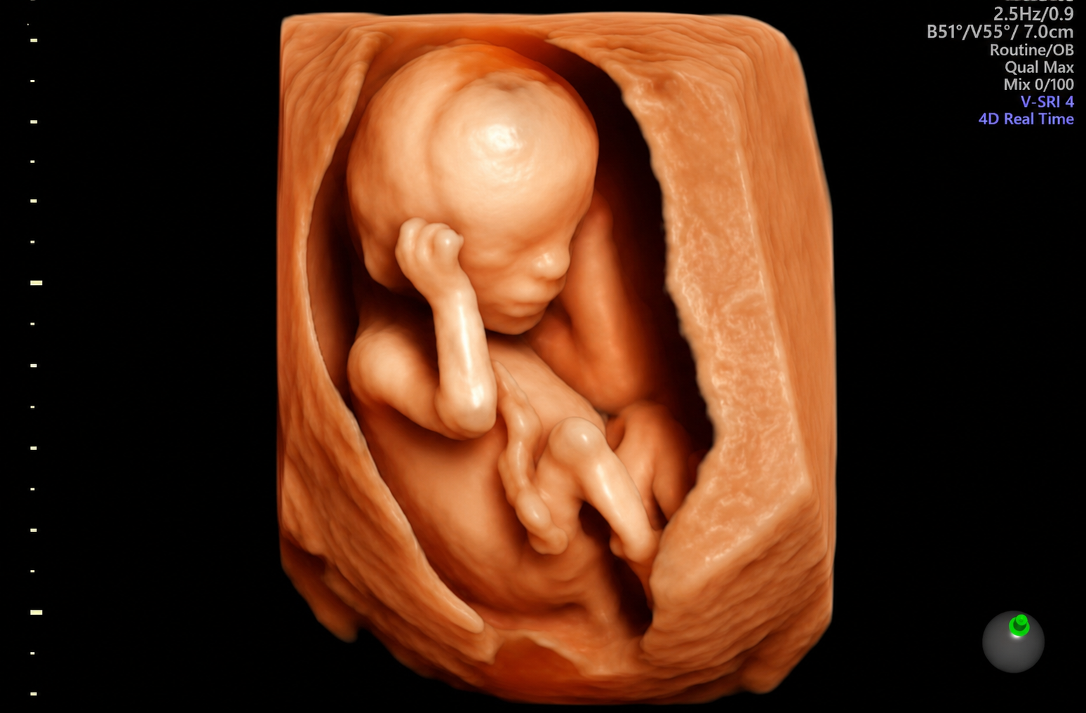 5-22 weeks