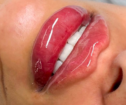 Lábios vermelhos e molhados parcialmente abertos, revelando dentes brancos.