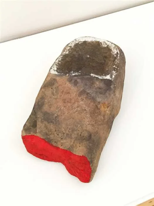 Severed Thumb