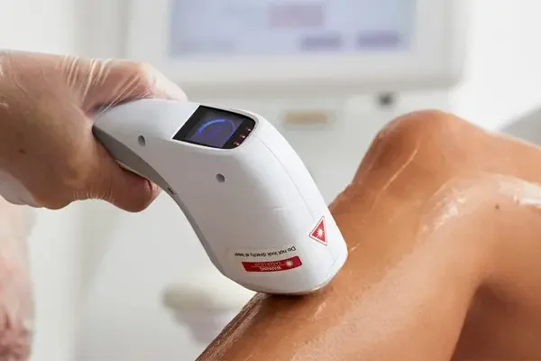A medical professional applies a laser treatment to a person's arm, likely for skin therapy or treatment.