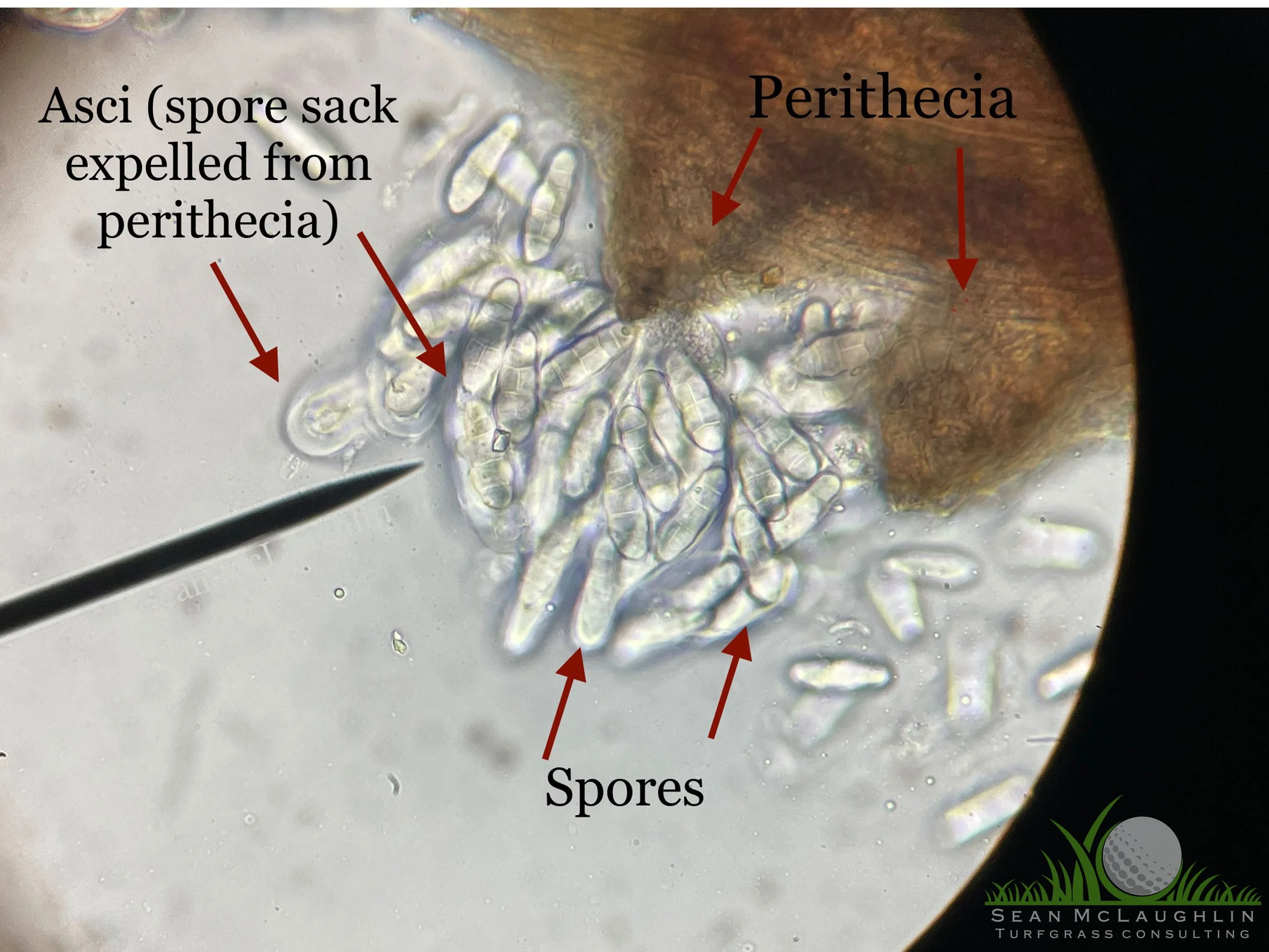Perithecia and spores on Poa annua leaf tissue - Industry, CA - © Sean P. McLaughlin