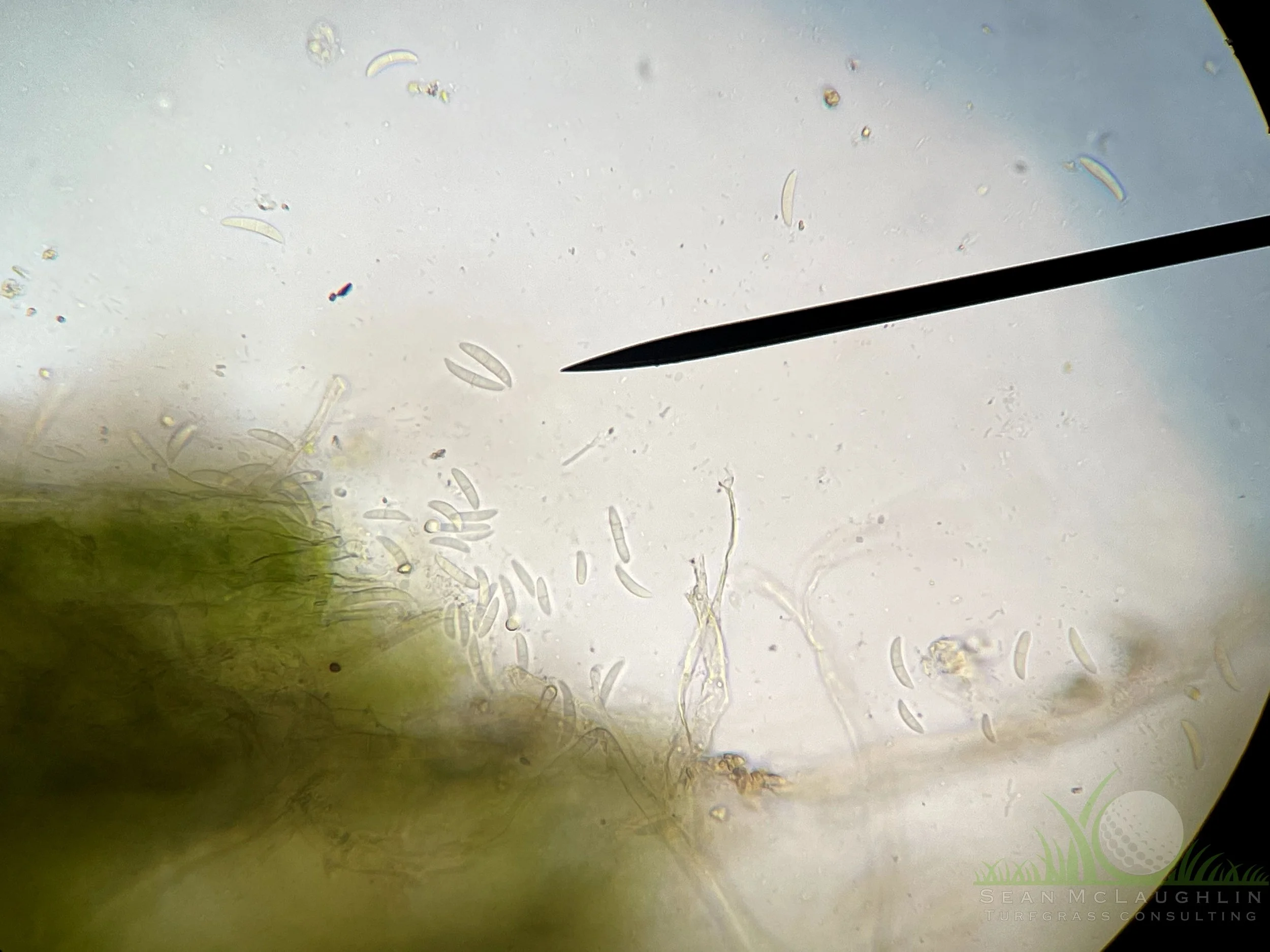 Conidia of Microdochium nivale - City of Industry, CA - © Sean P. McLaughlin