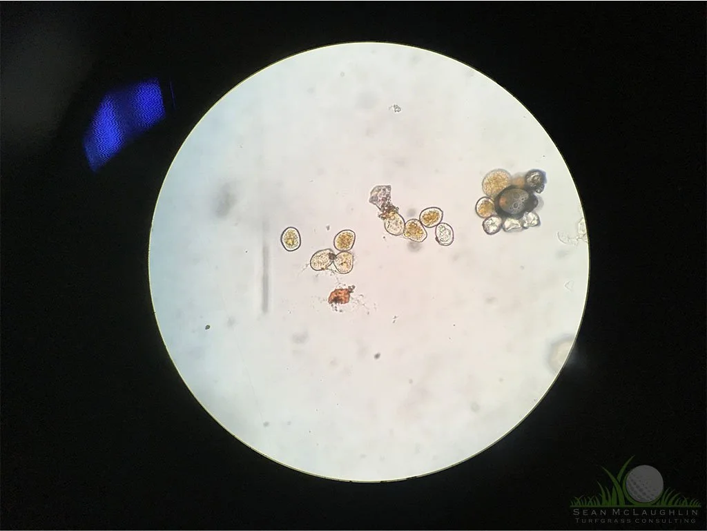 Spores under compound microscope - © Sean P. McLaughlin