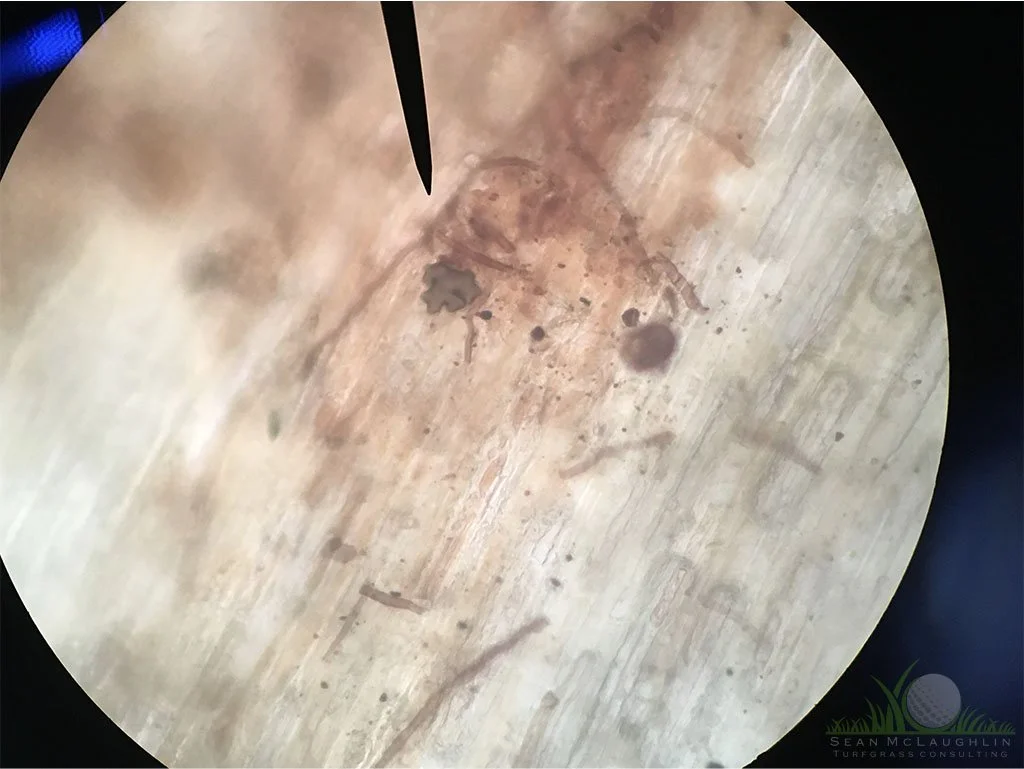 Puzzle piece shaped hyphopodia - Pomona, CA - © Sean P. McLaughlin