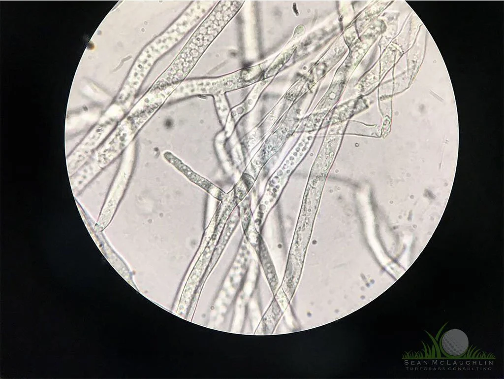 Right-angled branching of hyphae under compound microscope - © Sean P. McLaughlin