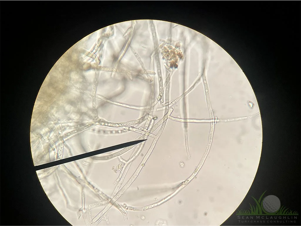 Right-angled branching of hyphae under compound microscope - © Sean P. McLaughlin 