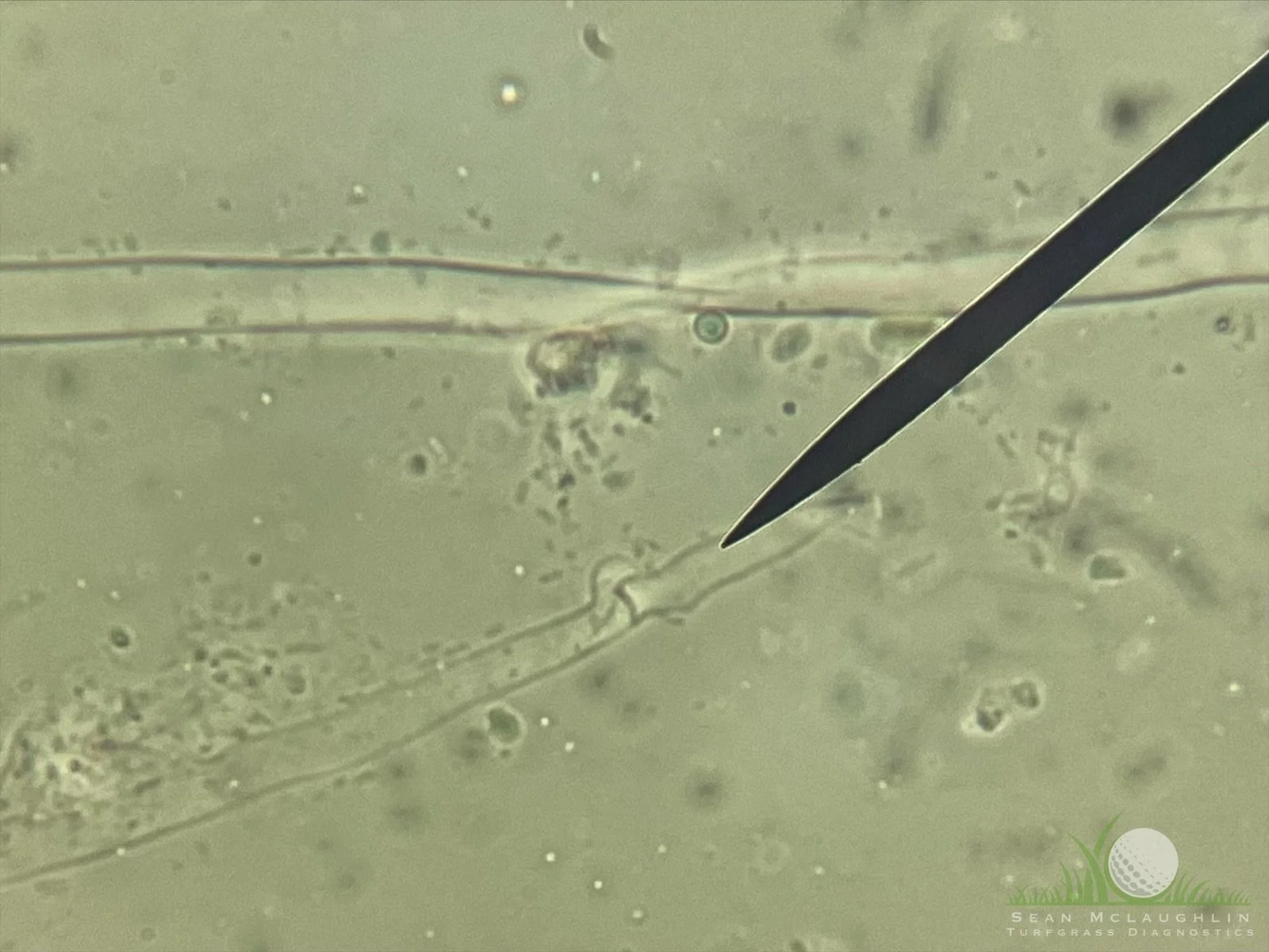 Clamp connection of Typhula incarnata under compound microscope - Big Bear, CA - © Sean P. McLaughlin
