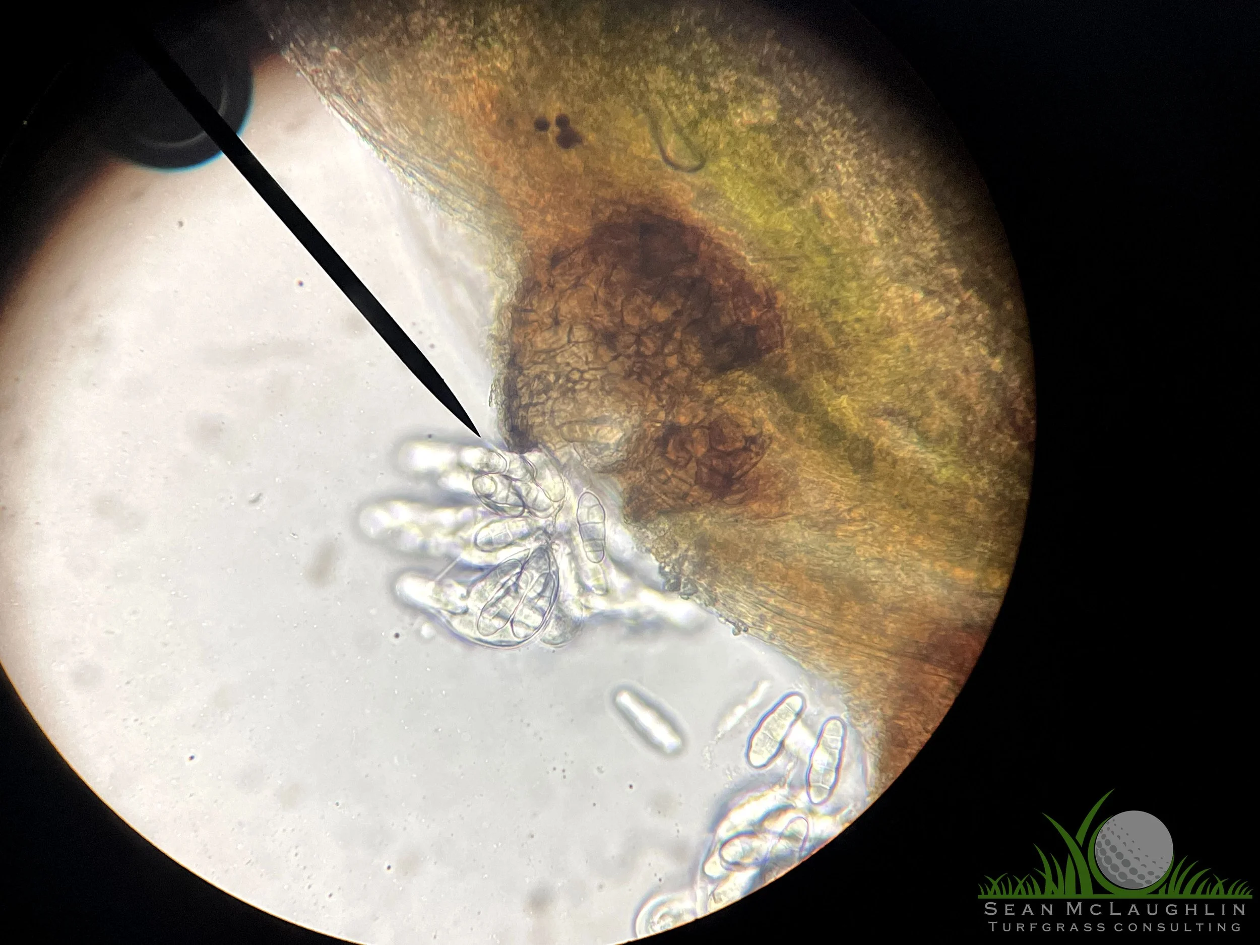 Perithecia and spores on Poa annua leaf tissue - Industry, CA - © Sean P. McLaughlin