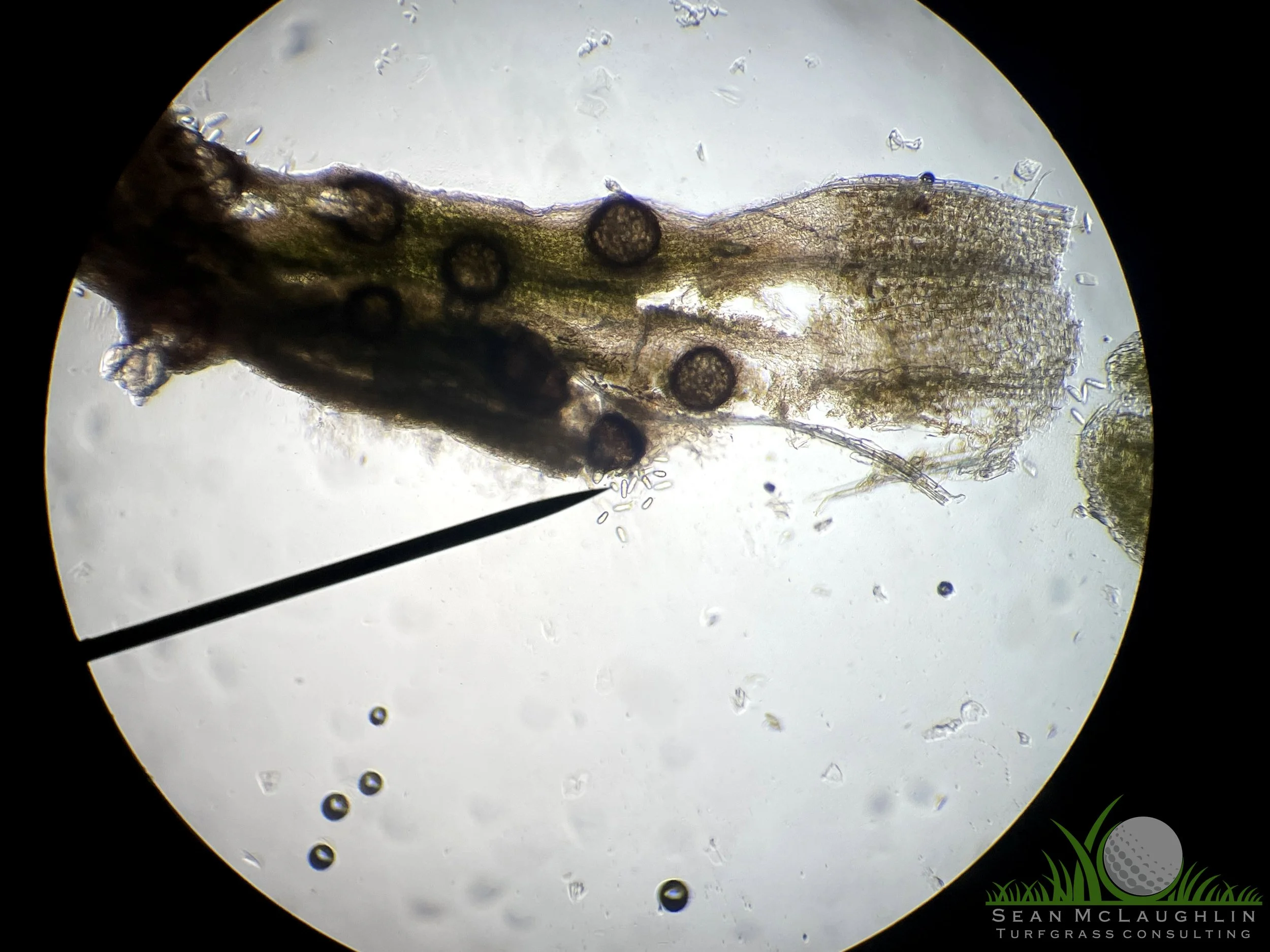 Perithecia and spores on Poa annua leaf tissue - Industry, CA - © Sean P. McLaughlin