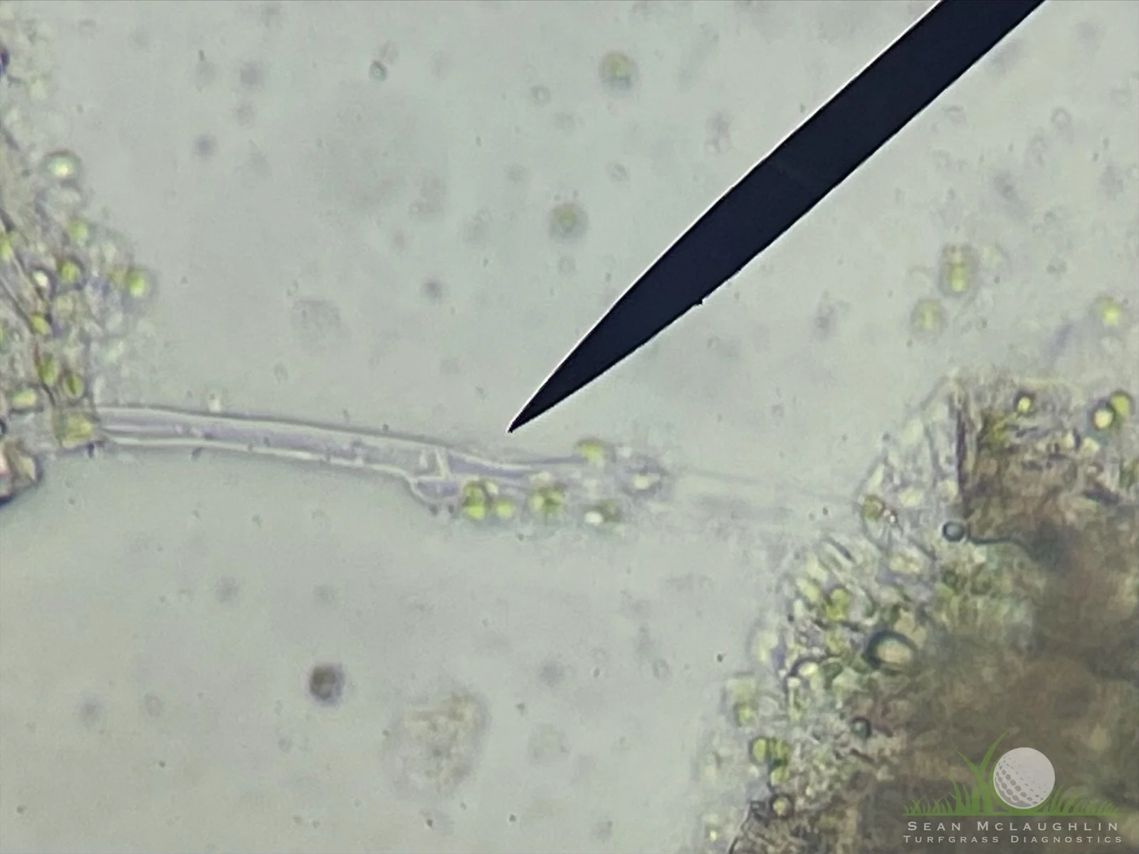 Clamp connection of Typhula incarnata under compound microscope - Big Bear, CA - © Sean P. McLaughlin