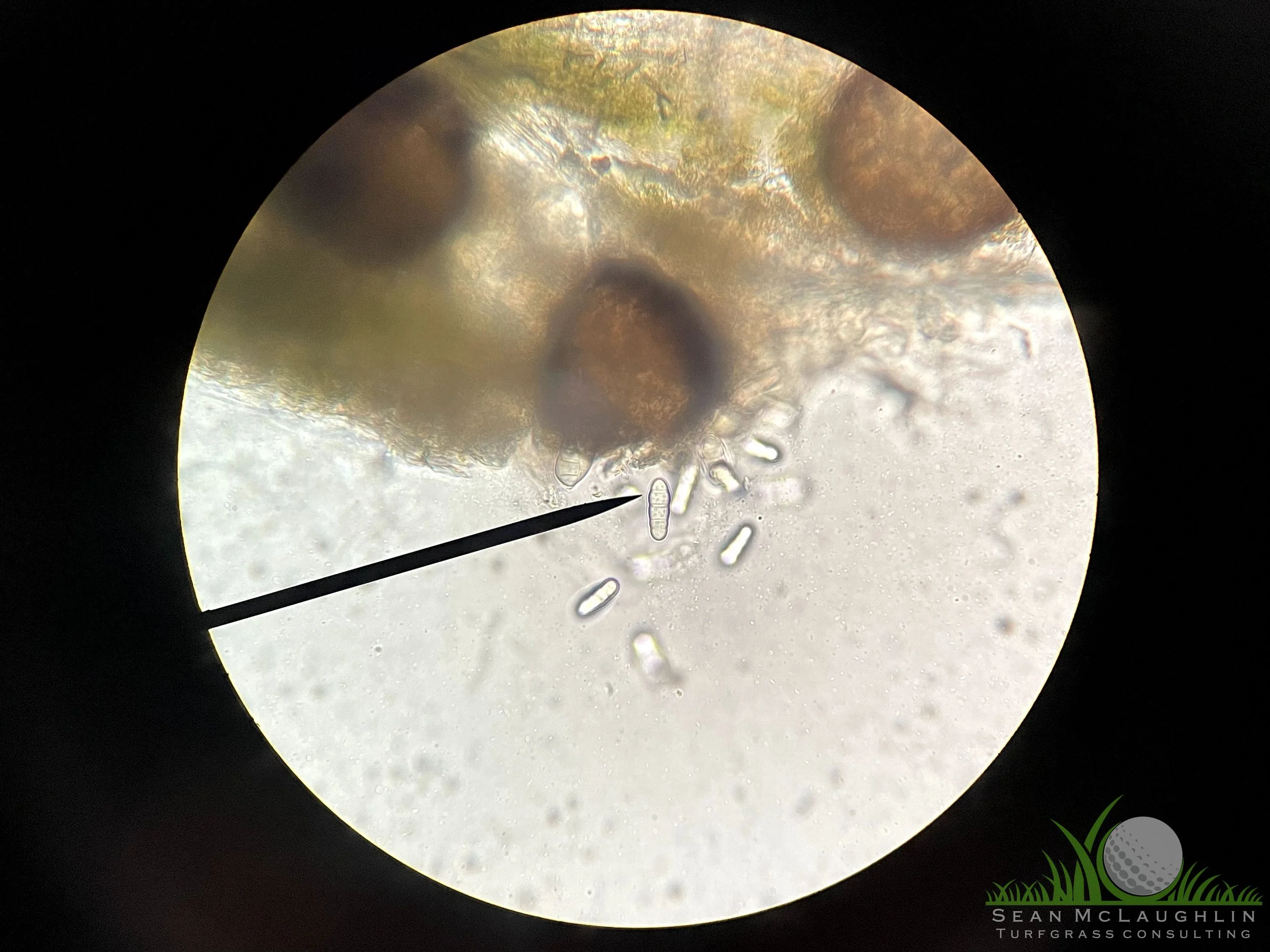 Perithecia and spores on Poa annua leaf tissue - Industry, CA - © Sean P. McLaughlin