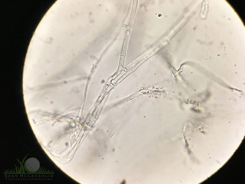 Clamp connection of hyphae under compound microscope - Pomona, CA - © Sean P. McLaughlin