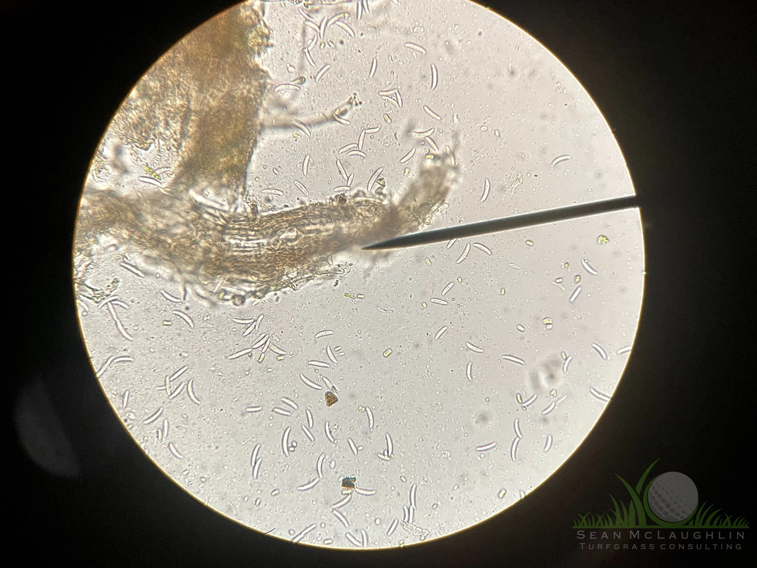 Conidia of Microdochium nivale - City of Industry, CA - © Sean P. McLaughlin