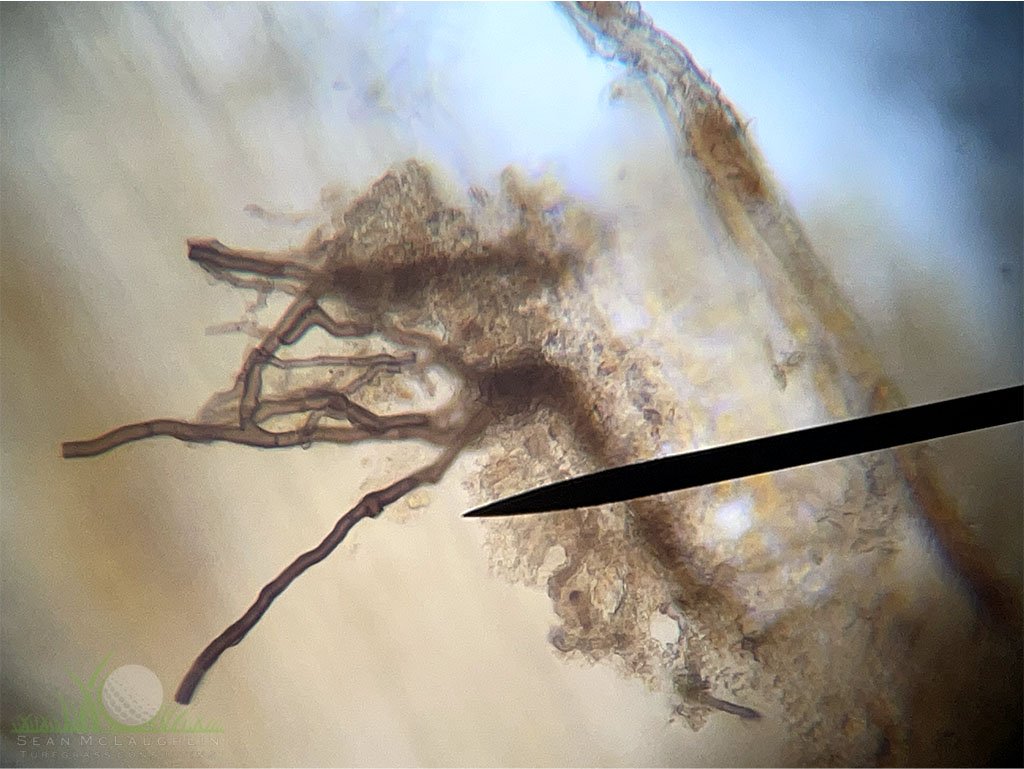 Dark ectotrophic hyphae from infected Hybrid Bermudagrass rhizome under compound microscope - City of Industry, CA - © Sean P. McLaughlin