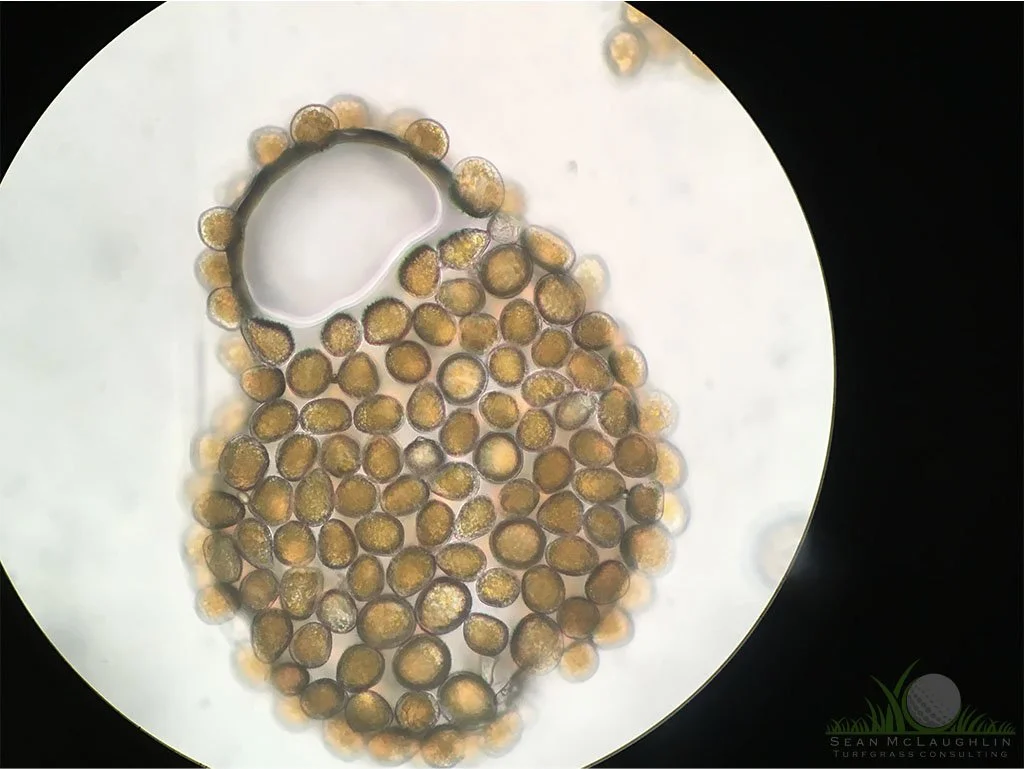 Spores under compound microscope - © Sean P. McLaughlin