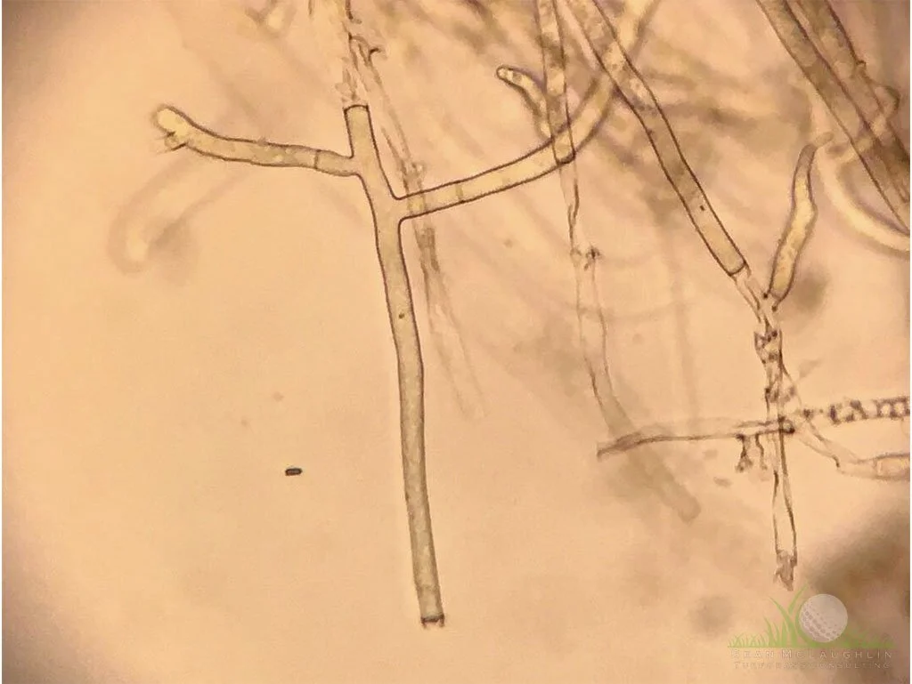 Right-angled branching of hyphae under compound microscope - © Sean P. McLaughlin