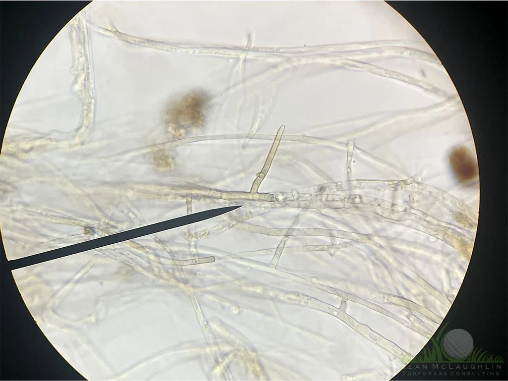 Right-angled branching of hyphae under compound microscope - © Sean P. McLaughlin 