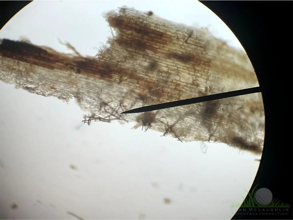 Dark ectotrophic hyphae from infected Hybrid Bermudagrass rhizome under compound microscope - City of Industry, CA - © Sean P. McLaughlin