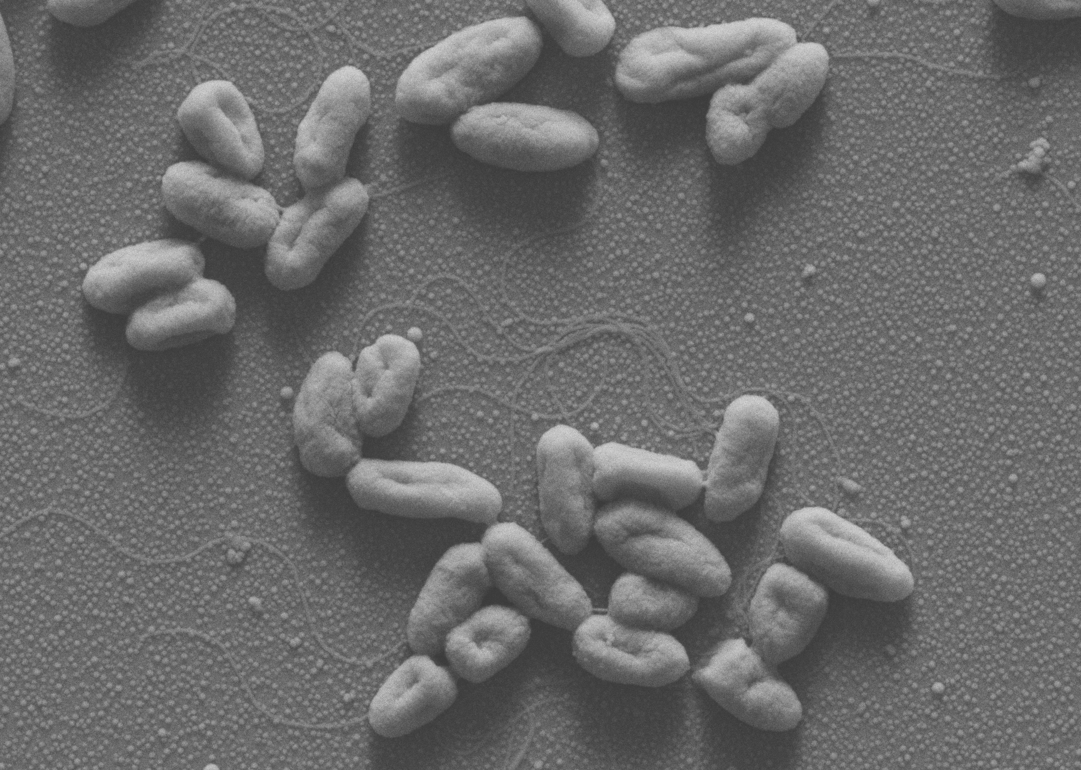 Black and white image of several irregularly shaped objects scattered on a textured surface, possibly resembling rocks or food items.