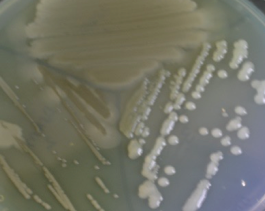 Close-up of bacterial colonies growing on agar plates in a laboratory setting.