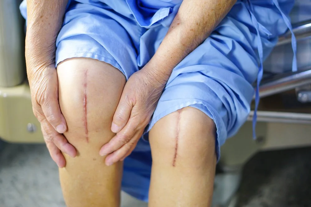 Massage After Surgery: What to Expect and When to Start