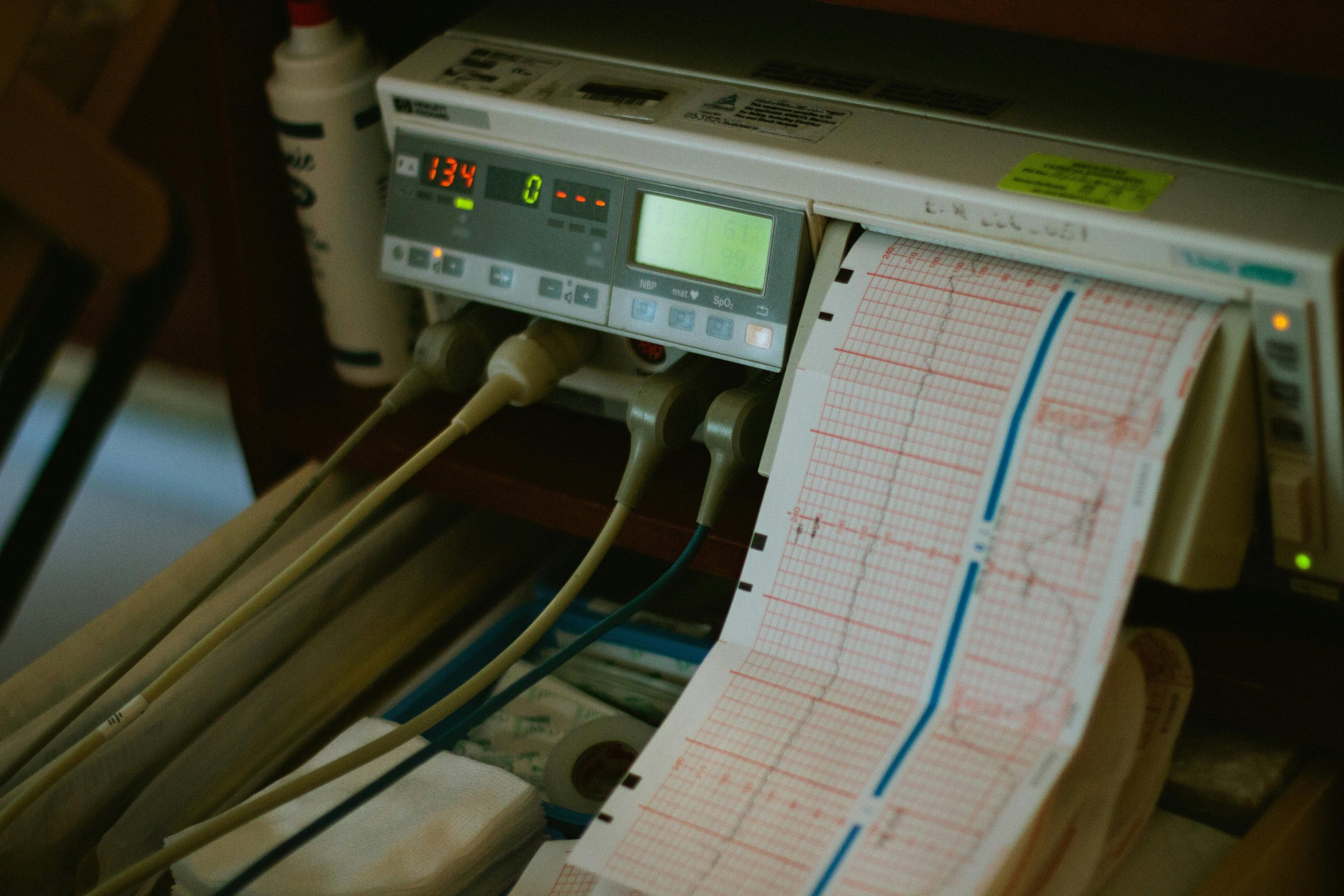 A medical monitor displaying vital signs with an electrocardiogram printout beneath, connected to patient cables.