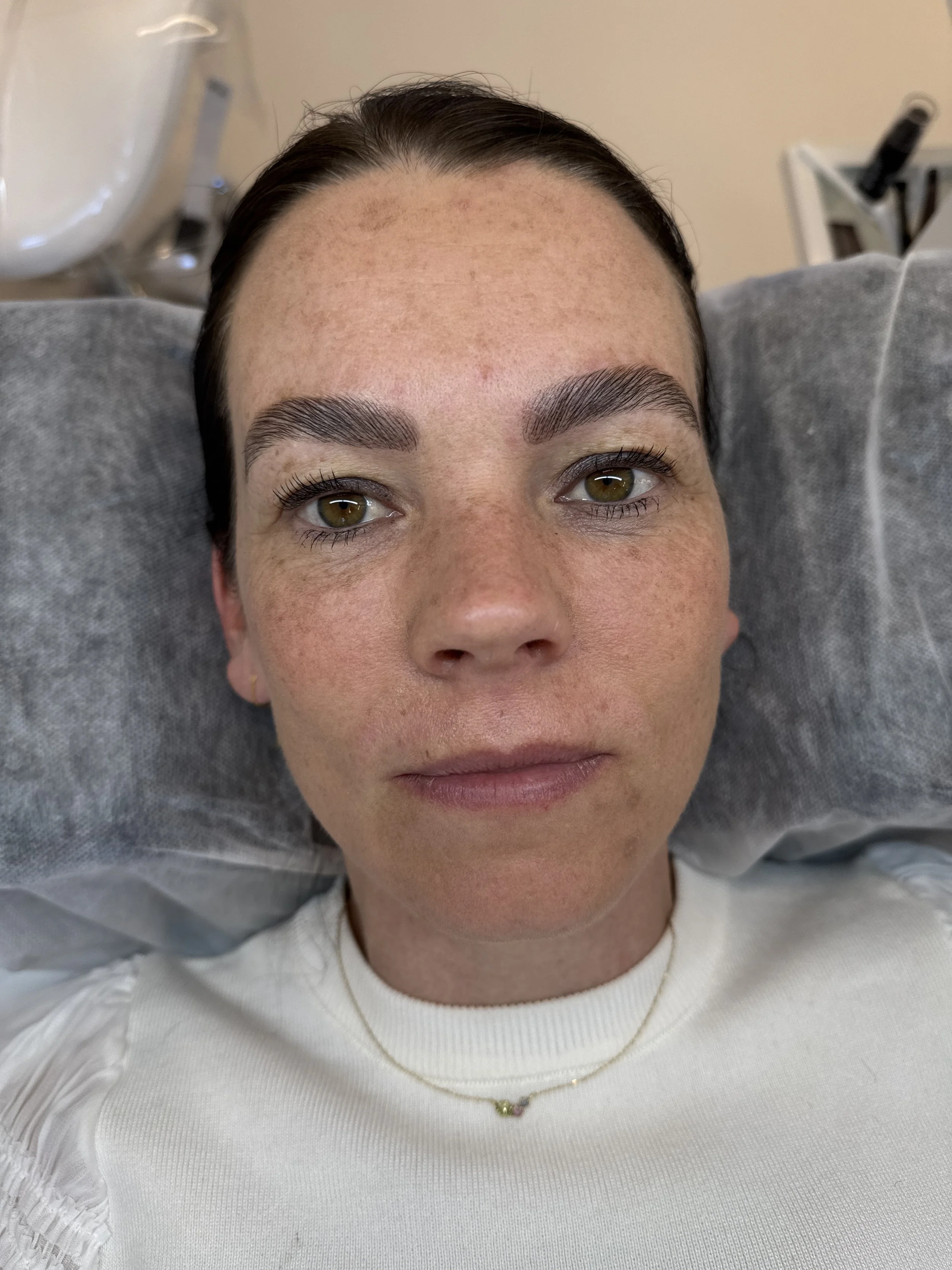 Nærbillede af en kvindes ansigt med brun øjenfarve, velplejede bryn og naturligt makeup, taget mens hun ligger i en hospitalsseng.