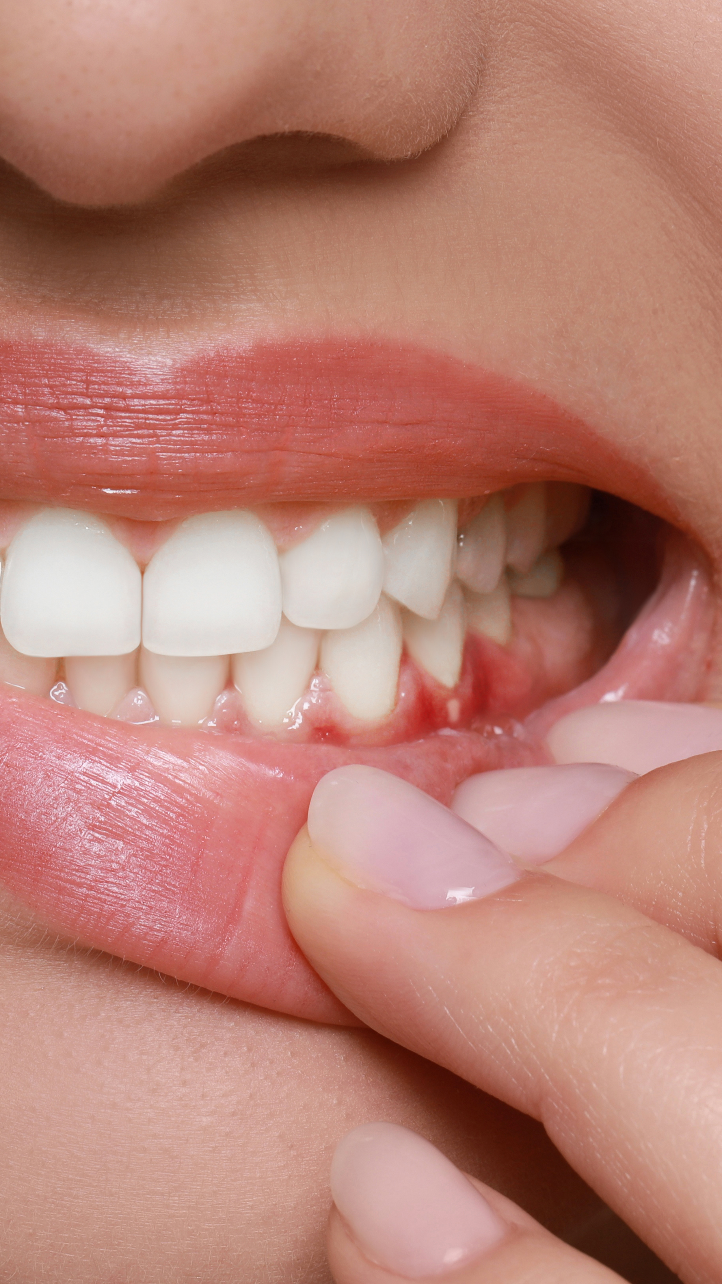 Close-up d'une bouche souriante avec des dents blanches, une lèvre supérieure rouge et une lèvre inférieure naturelle, une main tenant la joue.