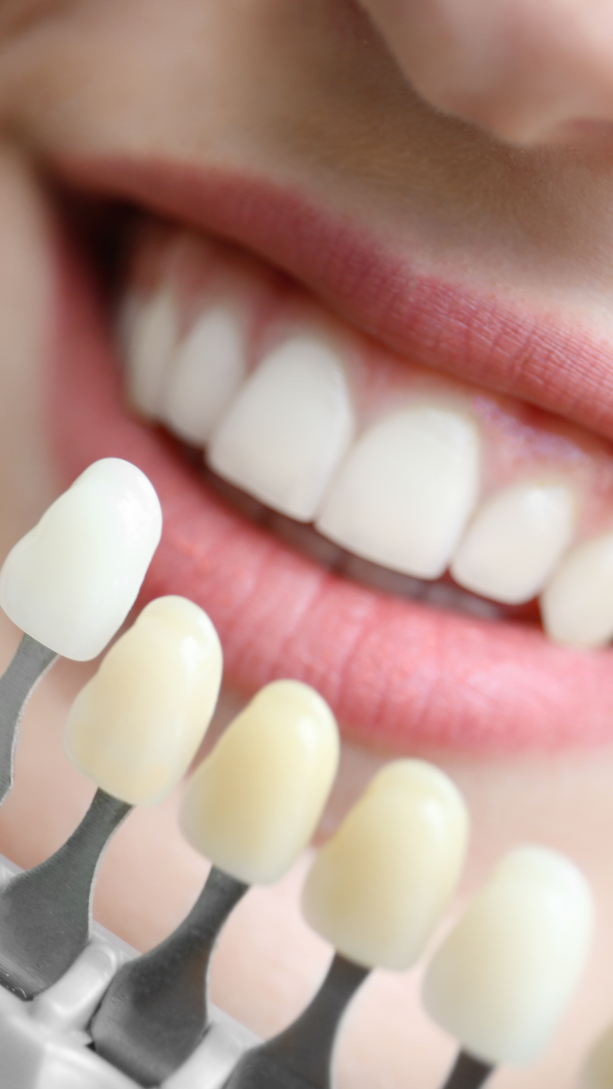 Une personne souriant, montrant ses dents blanches, avec une main portant une plaque de colorier blanc, probablement un modèle dentaire ou un outil de dentiste.